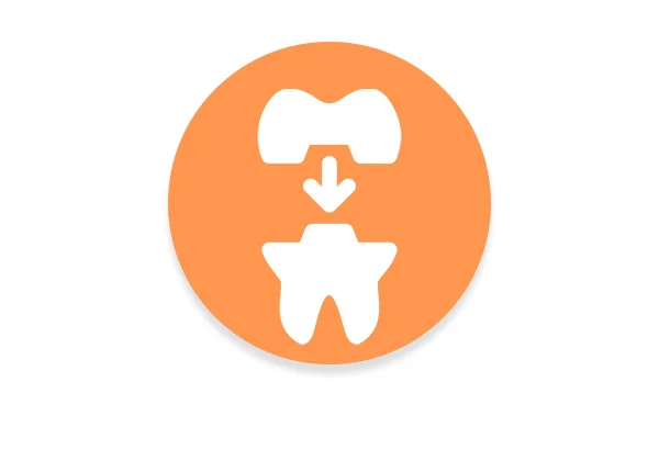 Cavity fillings